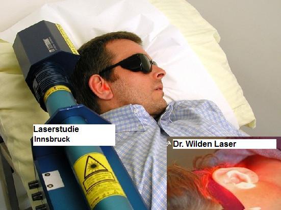 Vergleich der Laserbestrahlung Studie Innsbruck zu Laserbehandlung Dr. Wilden.